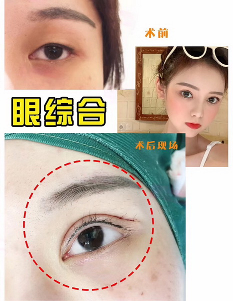 广州网红整形 