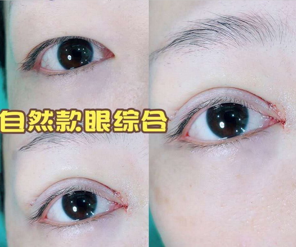 广州正规人气整形 