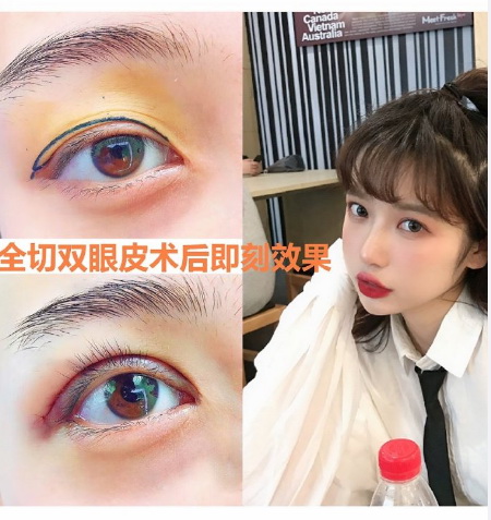 广州网红脸打造 