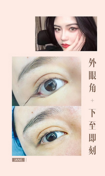 广州专业整形修复 