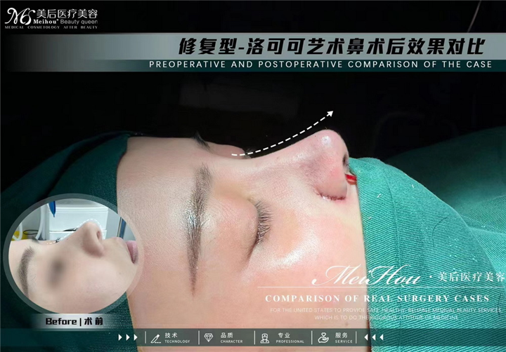 广州美后整形
