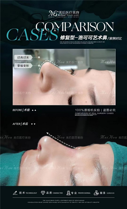 广州美后整形