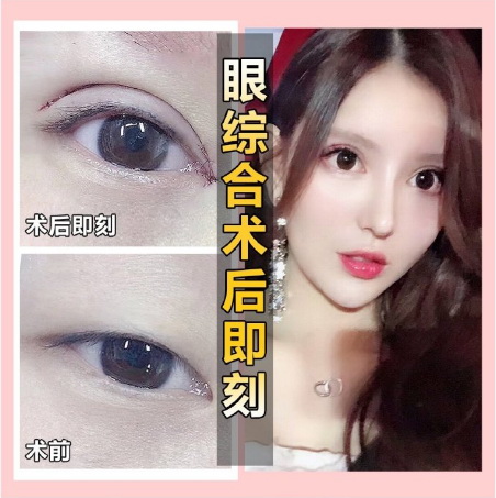 广州正规人气整形 