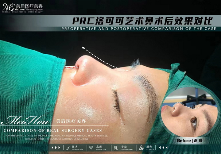 广州美后整形