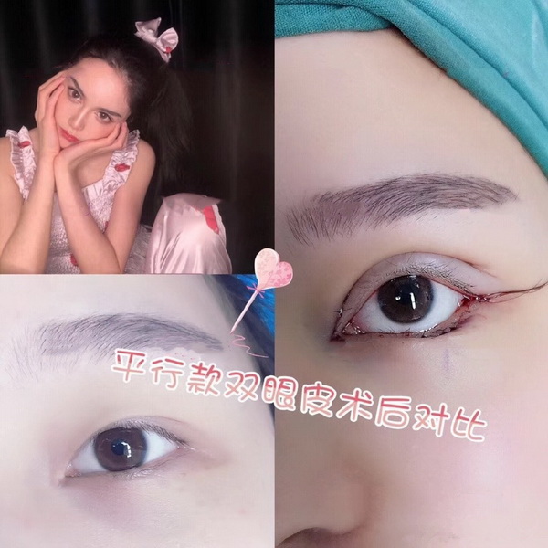 广州网红整形 