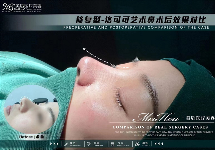 广州美后整形