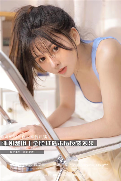 雅妍整形全脸打造术后反馈效果