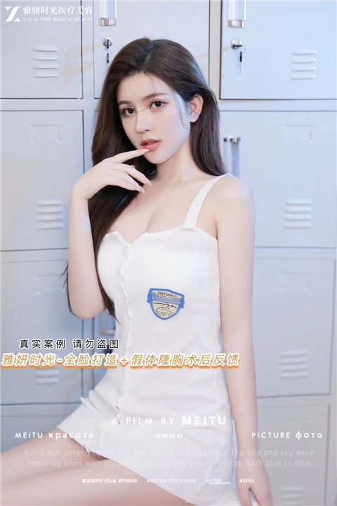 雅妍时光全脸打造假体隆胸术后反馈