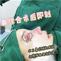 南京鼻综合整形专家