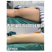 广州安丽维铂金医疗美容