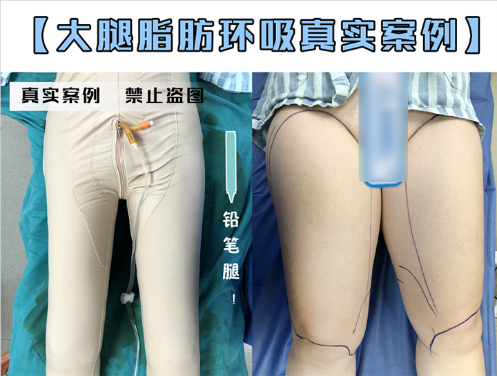 广州安丽维铂金医疗美容