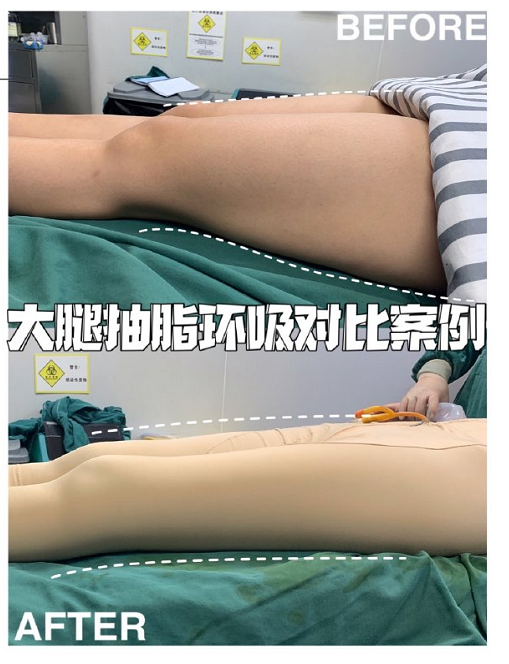 广州安丽维铂金医疗美容