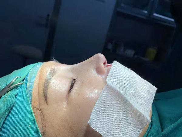 重庆鼻部整形医生 