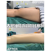 广州飞悦整形医院