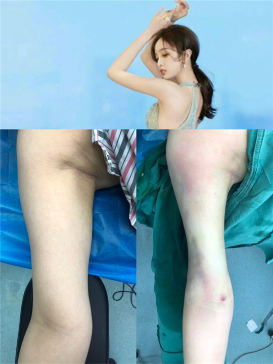 广州飞悦整形医院
