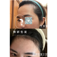 博妍生发