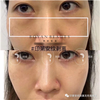 为什么有些印第安纹顶灯下才有