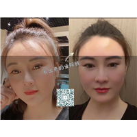 博妍生发毛囊激活