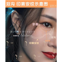 印第安纹泪沟用什么填充？