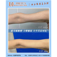 雷文斌教授上臂修复