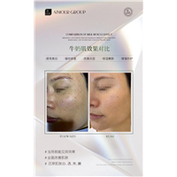 艾沫尔牛奶肌效果对比