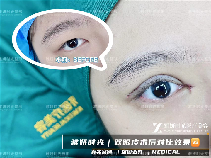 广州雅妍时光医疗整形