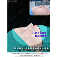广州鼻整形修复医生