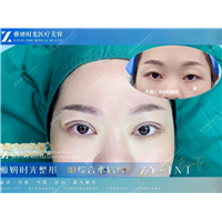 广州眼综合整形医院