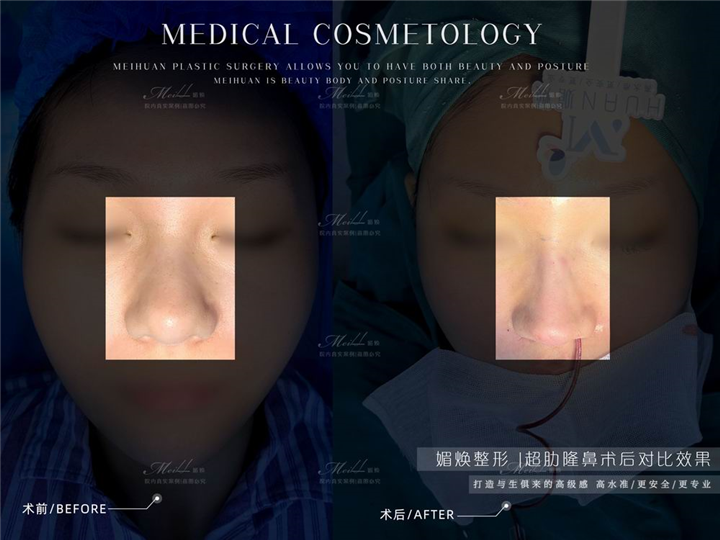 椒江媚焕医疗美容
