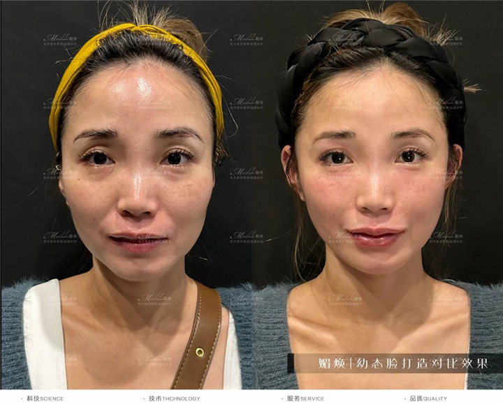 台州媚焕医美