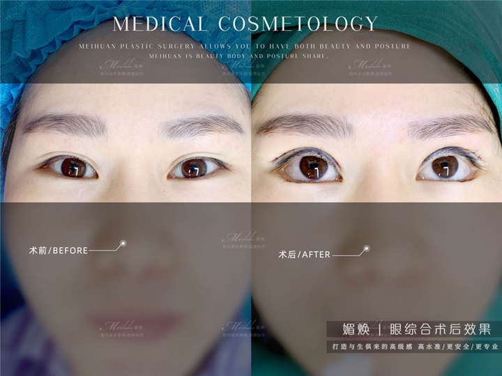 椒江媚焕医疗美容