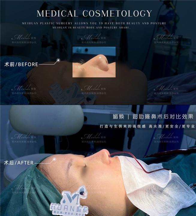 椒江媚焕医疗美容