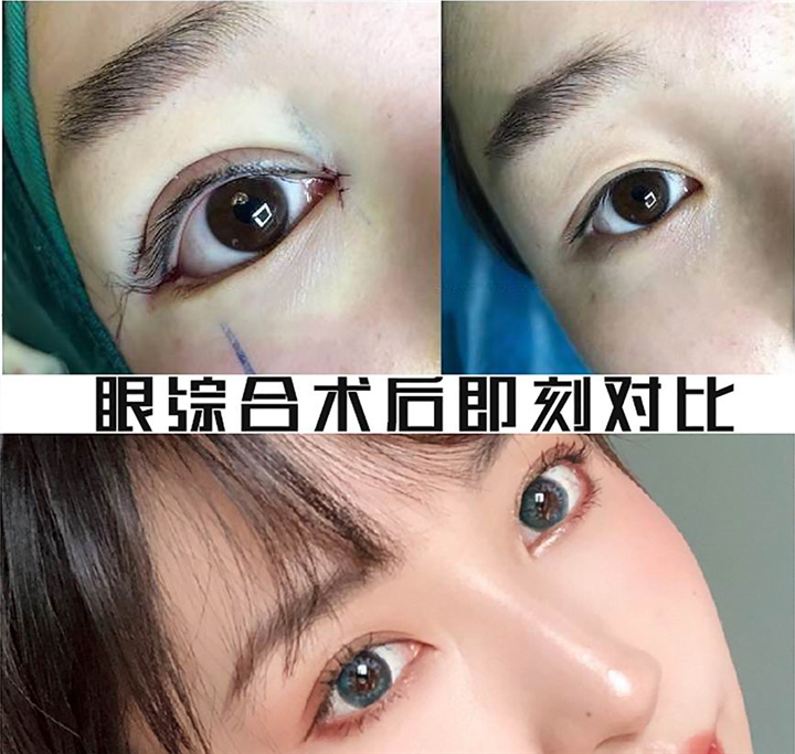 上海人气整形修复