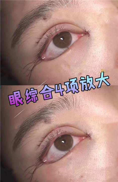 陈国杰整形专家