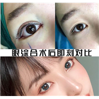 上海人气整形修复