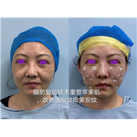 陈国杰整形专家