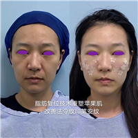 陈国杰整形专家