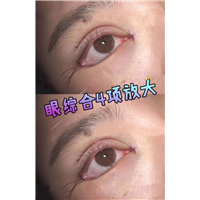 陈国杰整形专家