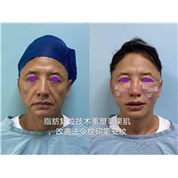 陈国杰整形专家