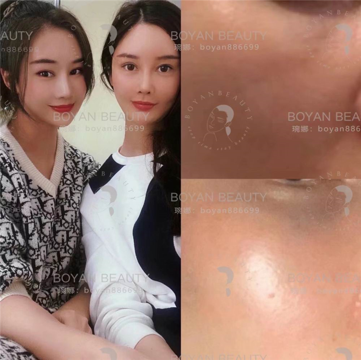 普宁博妍医美