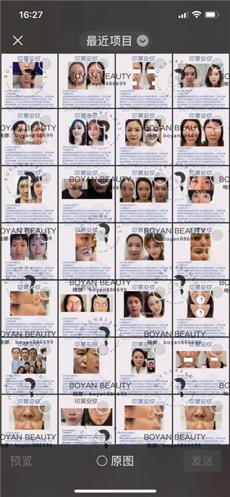 博妍剥离微整