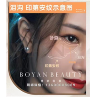 印第安纹怎么剥离