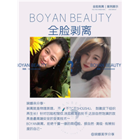 全脸剥离