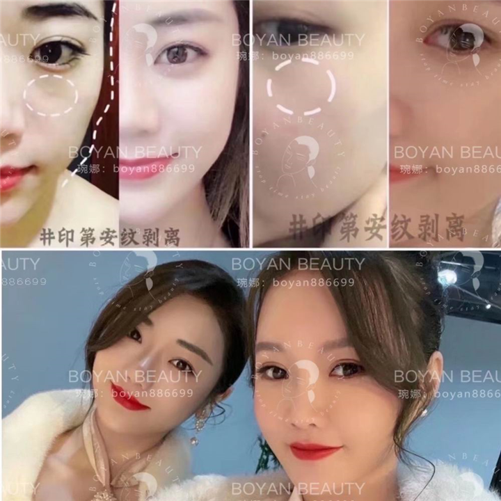 普宁博妍医美