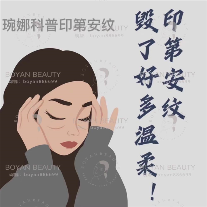 印第安纹剥离