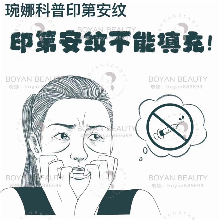 印第安纹剥离