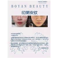 如何祛除印第安纹让琬娜告诉你
