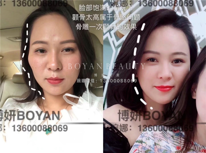 博妍骨雕
