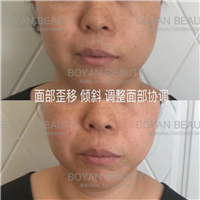 博妍骨雕