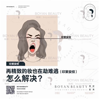 印第安纹剥离